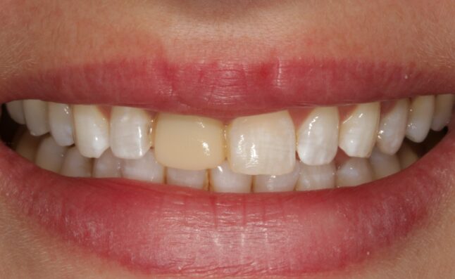 Before - temple street dental